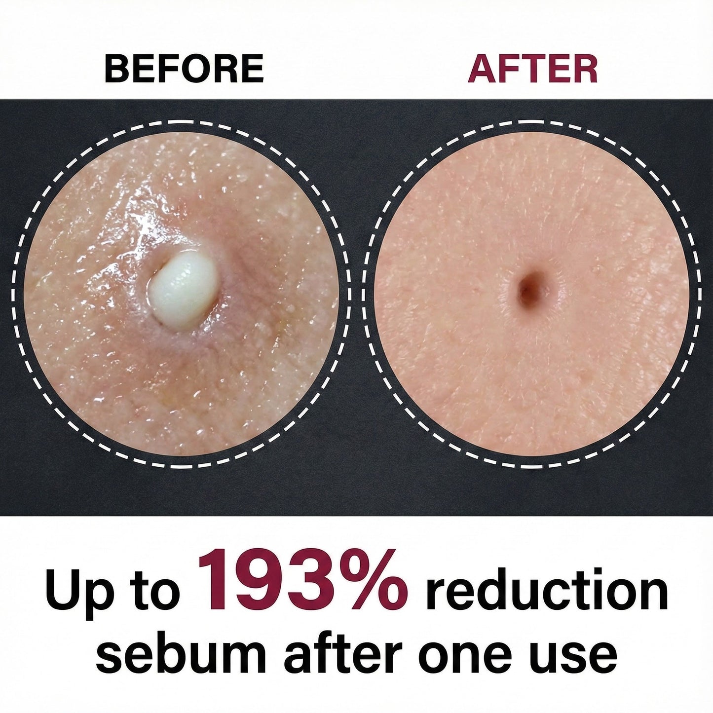 Velora™ Rice Glow Peel Shot – Instant Glass Skin Exfoliator (Duo)